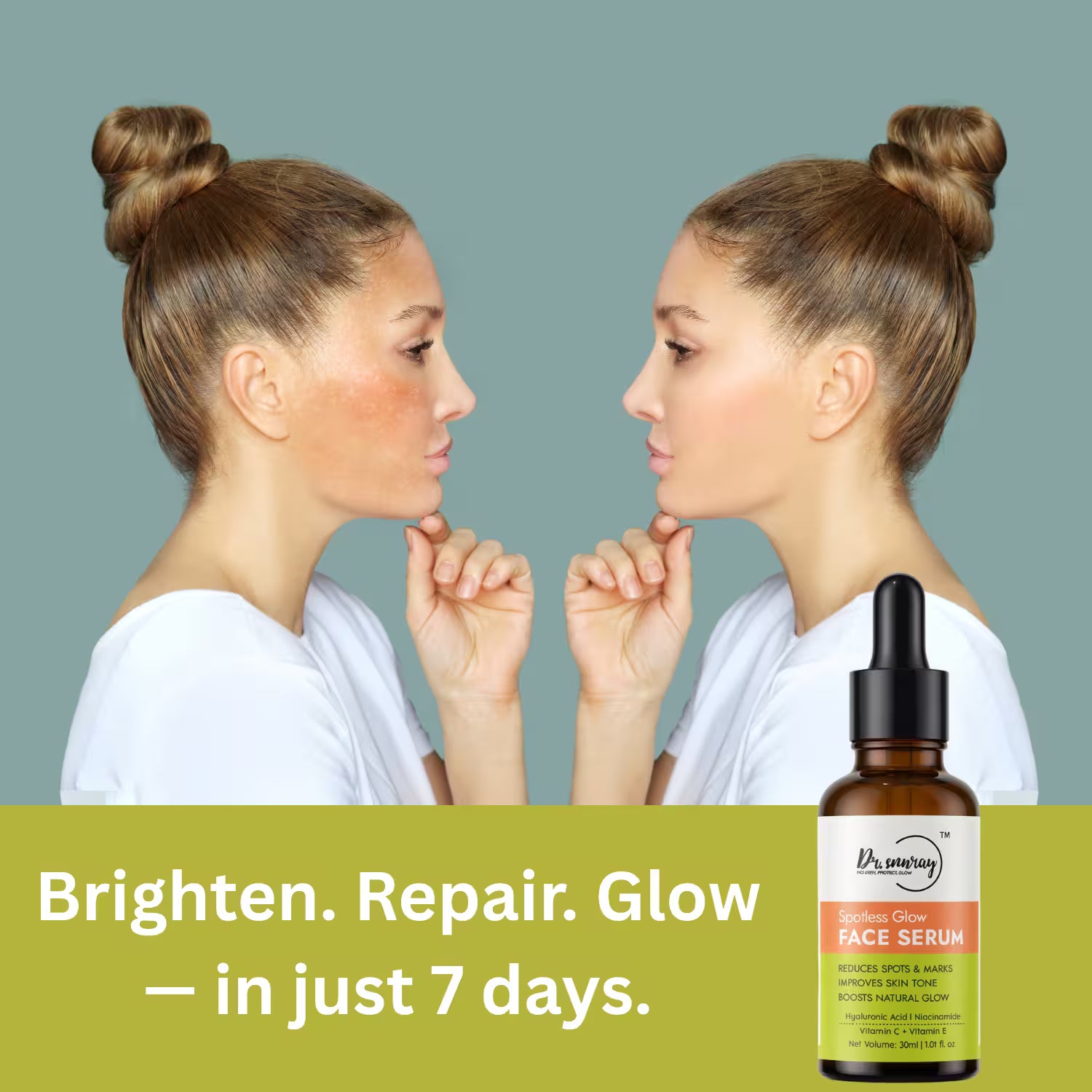 Spotless Glow Serum by Dr. Sunray | Brightening & Pigmentation Care